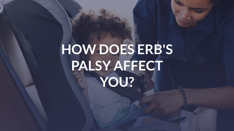 Birmingham Erb's Palsy Attorney