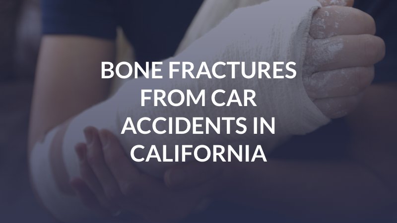 Bone Fractures from Car Accidents in California