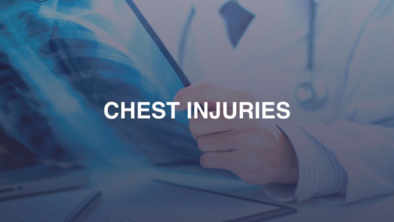 Chest Injuries in California