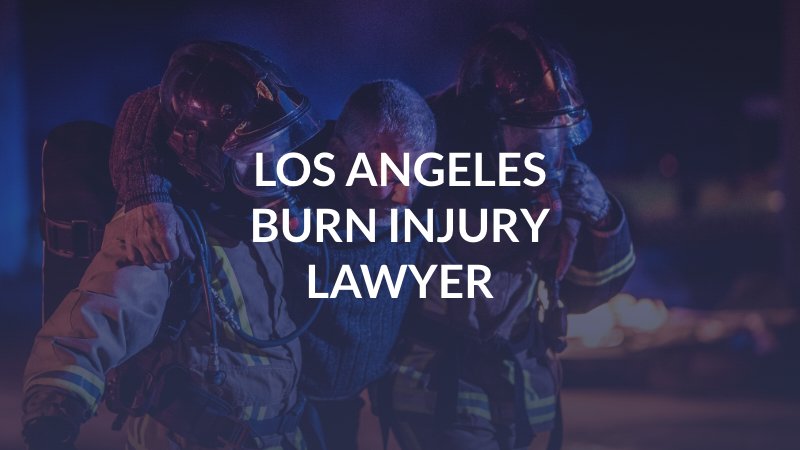 Los Angeles Burn Injury Lawyer