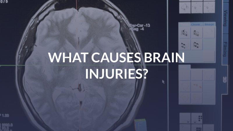 San Diego brain injury attorney